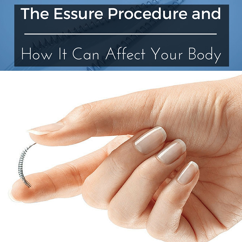 The Essure Procedure and How It Can Affect Your Body
